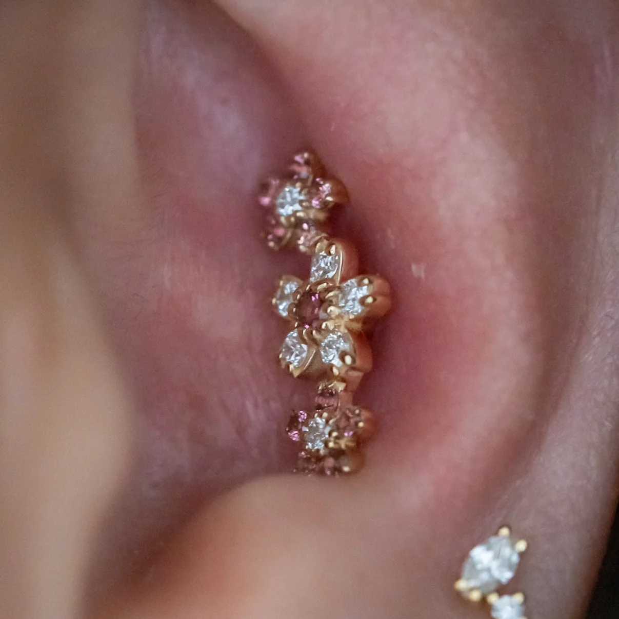Conch Piercing - Image 11