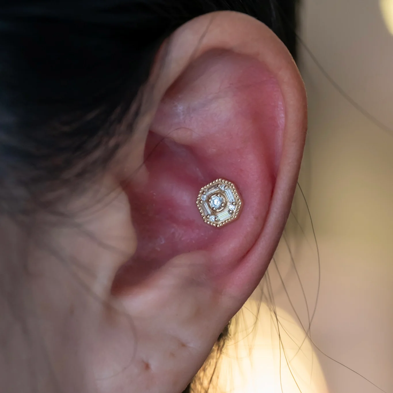 Conch Piercing - Image 4