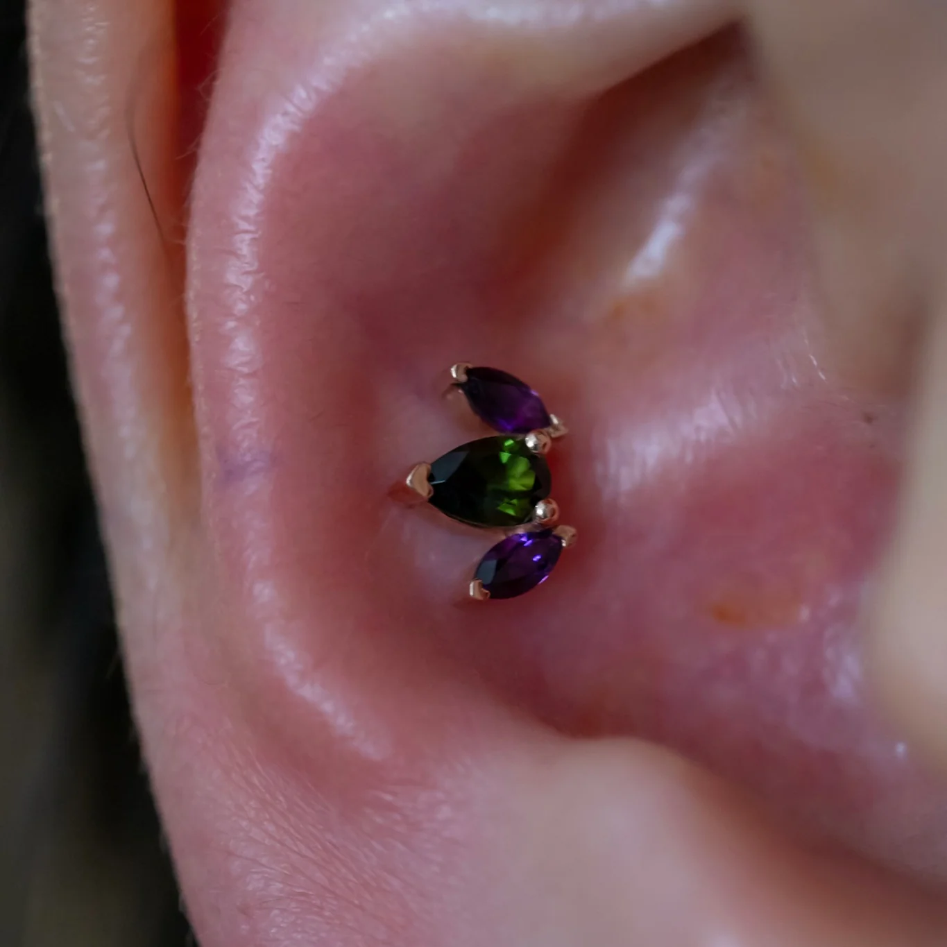 Conch Piercing - Image 5