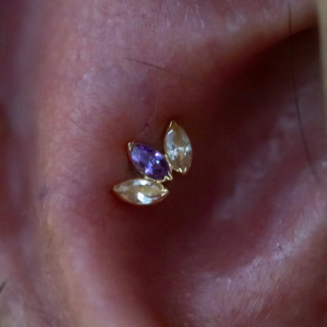 Conch Piercing - Image 6