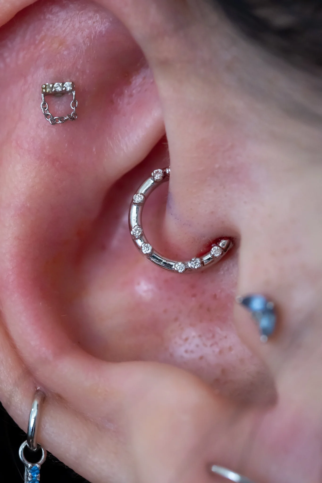 Daith Piercing - Image 9