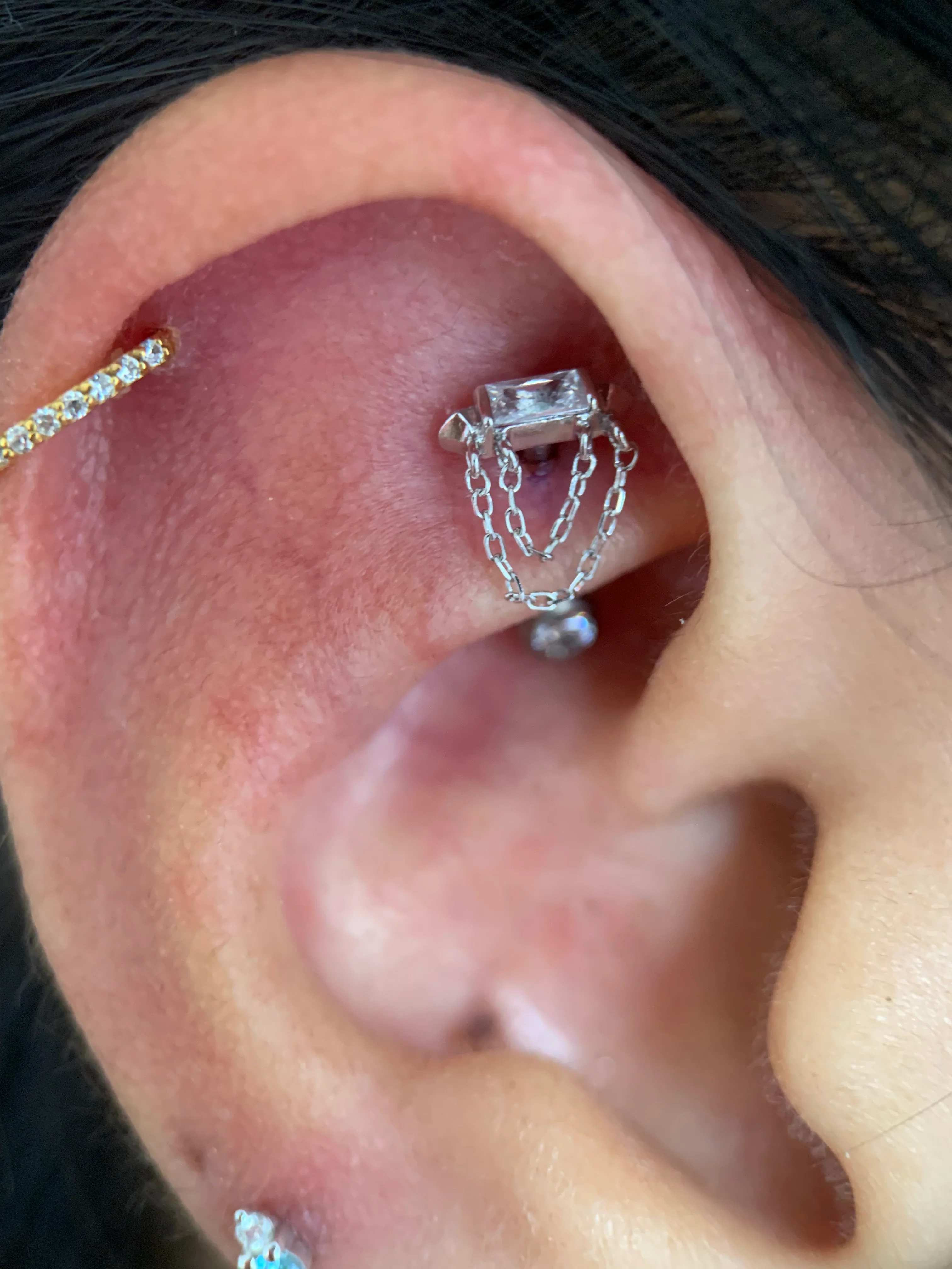 Rook Piercing - Image 9